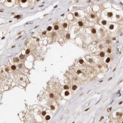 Immunohistochemistry-Paraffin: Transketolase Antibody [NBP1-87442]
