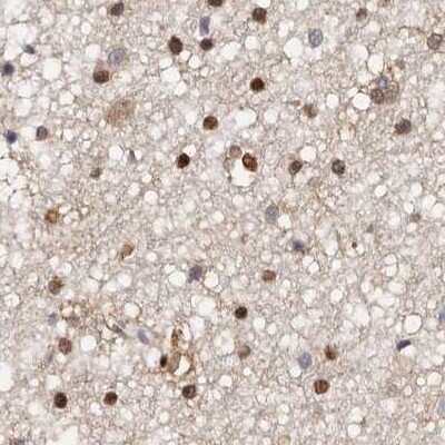 Immunohistochemistry-Paraffin: Transketolase Antibody [NBP1-87442]
