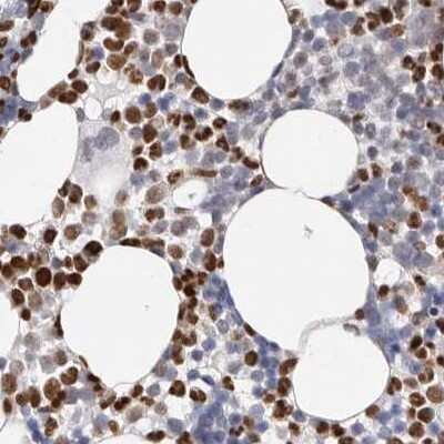 Immunohistochemistry-Paraffin: Transketolase Antibody [NBP1-87442]