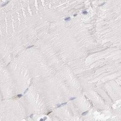 Immunohistochemistry-Paraffin: Transketolase Antibody [NBP1-87442]