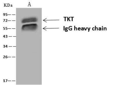 Immunoprecipitation: Transketolase Antibody [NBP3-12646]