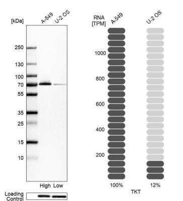 Western Blot: Transketolase Antibody [NBP1-87441]