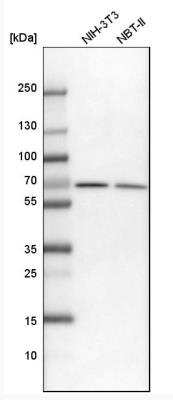 Western Blot: Transketolase Antibody [NBP1-87441]