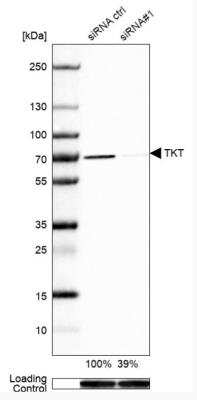 Western Blot: Transketolase Antibody [NBP1-87441]