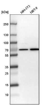 Western Blot: Transketolase Antibody [NBP1-87442]