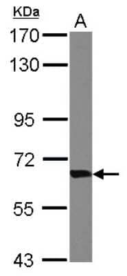 Western Blot: Transketolase Antibody [NBP2-20699]