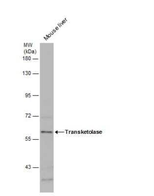 Western Blot: Transketolase Antibody [NBP2-20699]