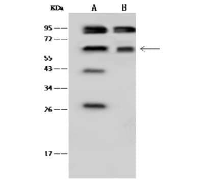 Western Blot: Transketolase Antibody [NBP2-99344]