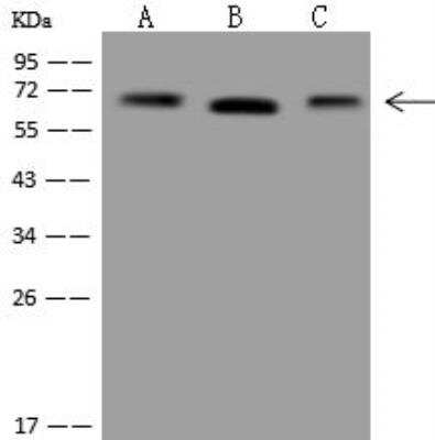 Western Blot: Transketolase Antibody [NBP3-12646]