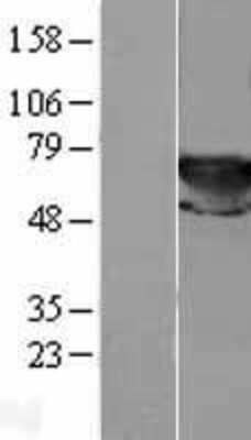 Western Blot: Transketolase Overexpression Lysate [NBL1-16940]