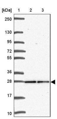 Western Blot: Translin Antibody [NBP2-31779]