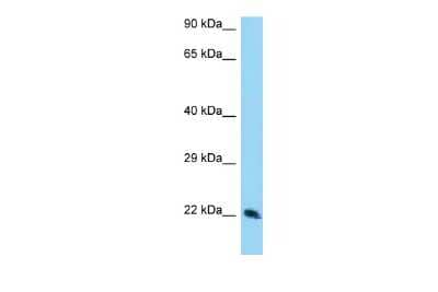 Western Blot: Translin Antibody [NBP2-85977]