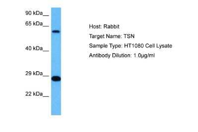 Western Blot: Translin Antibody [NBP2-85979]