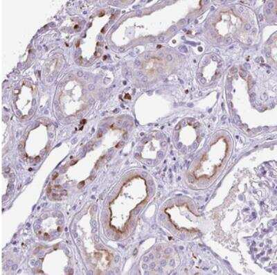 Immunohistochemistry: TMEM200C Antibody [NBP2-30818]