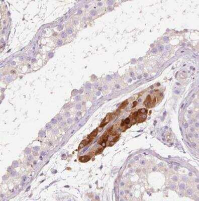 Immunohistochemistry: TMEM235 Antibody [NBP2-30839]