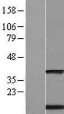 Western Blot: TMEM59 Overexpression Lysate [NBL1-17093]