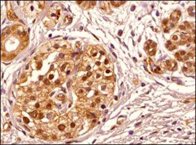 Immunohistochemistry-Paraffin: Transportin 1 Antibody (D45) - BSA Free [NB600-1397]