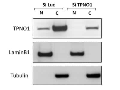 Western Blot: Transportin 1 Antibody (D45)BSA Free [NB600-1397]