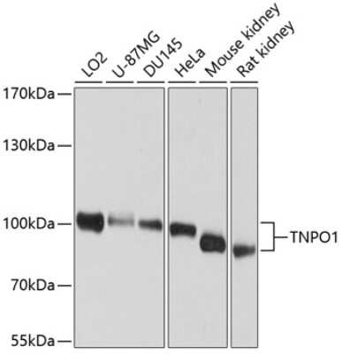 Western Blot: Transportin 1 AntibodyBSA Free [NBP2-93233]