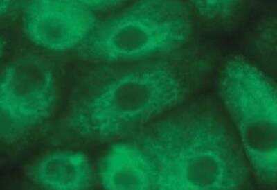 Immunocytochemistry/ Immunofluorescence: Transthyretin/Prealbumin Antibody (CL0290) [NBP2-52905]