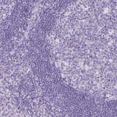 Immunohistochemistry-Paraffin: Transthyretin/Prealbumin Antibody (CL0290) [NBP2-52905]