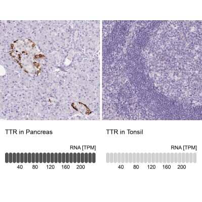 Immunohistochemistry-Paraffin: Transthyretin/Prealbumin Antibody (CL0290) [NBP2-52905]