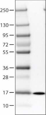 Western Blot: Transthyretin/Prealbumin Antibody (CL0290) [NBP2-52905]