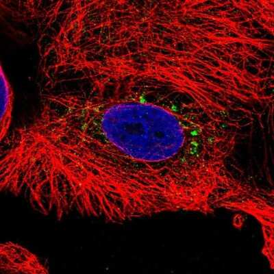 Immunocytochemistry/ Immunofluorescence: Transthyretin/Prealbumin Antibody [NBP1-89649]