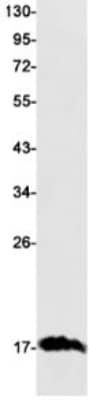 Western Blot: Transthyretin/Prealbumin Antibody (S07-4A2) [NBP3-19744]