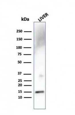 Western Blot: Transthyretin/Prealbumin Antibody (TTR/4292) [NBP3-07742]