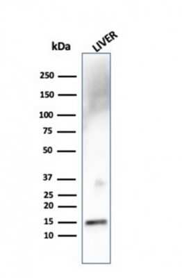 Western Blot: Transthyretin/Prealbumin Antibody (TTR/4292)Azide and BSA Free [NBP3-08765]