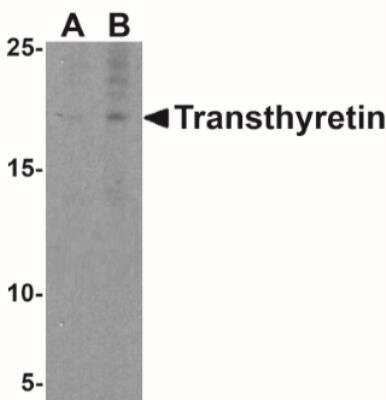 Western Blot: Transthyretin/Prealbumin AntibodyBSA Free [NBP2-41101]