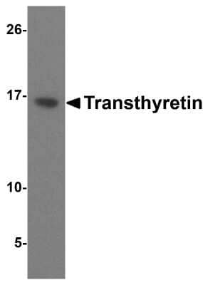 Western Blot: Transthyretin/Prealbumin AntibodyBSA Free [NBP2-41101]