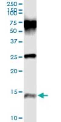 Immunoprecipitation: Trappin-2/Elafin/Skalp Antibody (2G20) [H00005266-M02]