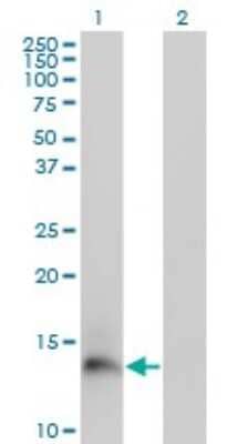 Western Blot: Trappin-2/Elafin/Skalp Antibody (2G20) [H00005266-M02]