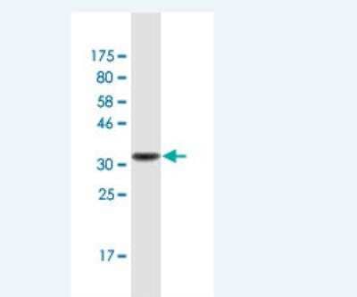 Western Blot: Trappin-2/Elafin/Skalp Antibody (3C4) [H00005266-M03]