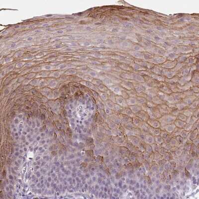 Immunohistochemistry-Paraffin: Trappin-2/Elafin/Skalp Antibody [NBP1-85690]