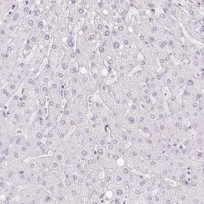 Immunohistochemistry-Paraffin: Trappin-2/Elafin/Skalp Antibody [NBP1-85690]