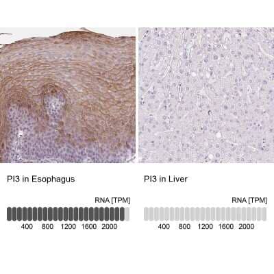 Immunohistochemistry-Paraffin: Trappin-2/Elafin/Skalp Antibody [NBP1-85690]