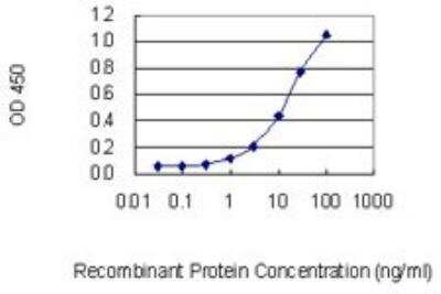 ELISA: Treacher Collins syndrome protein Antibody (8H3) [H00006949-M02]
