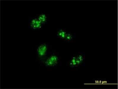 Immunocytochemistry/ Immunofluorescence: Treacher Collins syndrome protein Antibody (8H3) [H00006949-M02]