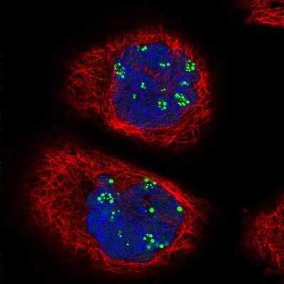 Immunocytochemistry/ Immunofluorescence: Treacher Collins syndrome protein Antibody [NBP1-86909]