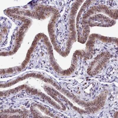 Immunohistochemistry-Paraffin: Treacher Collins syndrome protein Antibody [NBP1-86908]