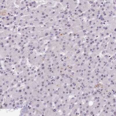 Immunohistochemistry-Paraffin: Treacher Collins syndrome protein Antibody [NBP1-86908]