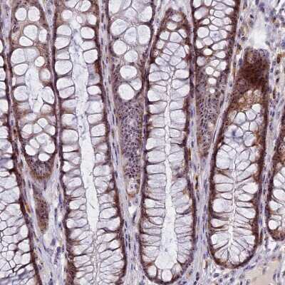 Immunohistochemistry-Paraffin: Treacher Collins syndrome protein Antibody [NBP1-86908]