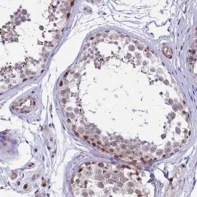 Immunohistochemistry-Paraffin: Treacher Collins syndrome protein Antibody [NBP1-86908]