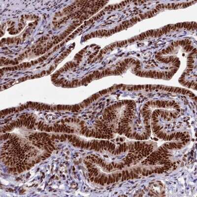 Immunohistochemistry-Paraffin: Treacher Collins syndrome protein Antibody [NBP1-86909]