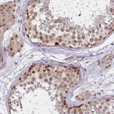 Immunohistochemistry-Paraffin: Treacher Collins syndrome protein Antibody [NBP1-86909]