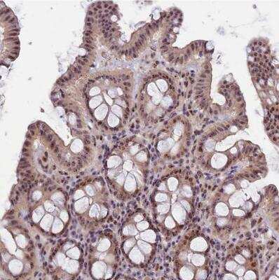 Immunohistochemistry-Paraffin: Treacher Collins syndrome protein Antibody [NBP1-86909]