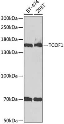 Western Blot: Treacher Collins syndrome protein AntibodyBSA Free [NBP3-03783]